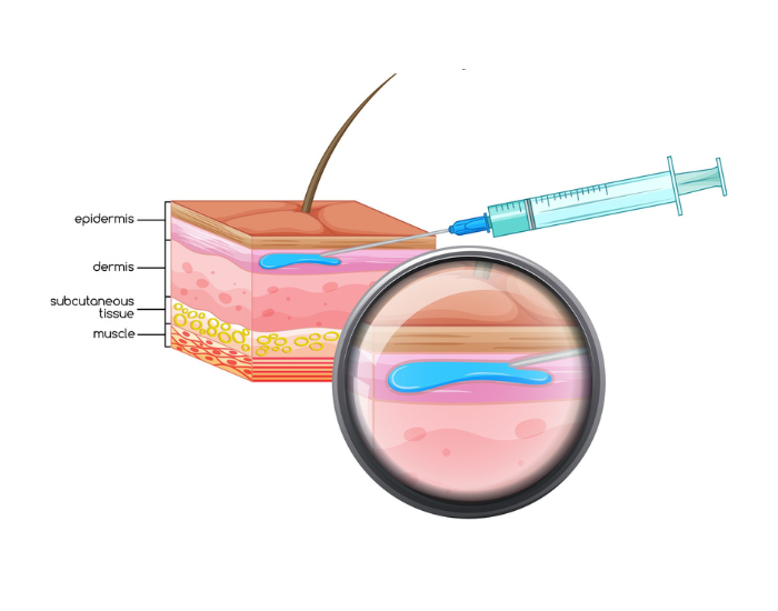 Intradermal Injection on White Background